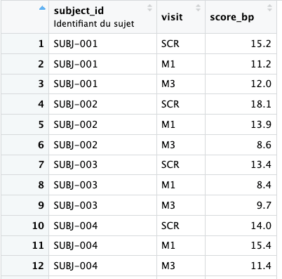 Passer de SAS à R - exemple de code R pour data manager"