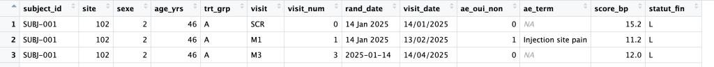 Passer de SAS à R - exemple de code R pour data manager
